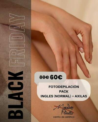 Black Friday 2025 Centro de Estética Mercedes Patallo (Gijón) Tratamientos faciales, corporales y cosmética