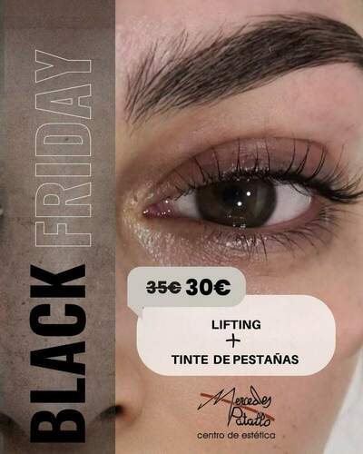 Black Friday 2025 Centro de Estética Mercedes Patallo (Gijón) Tratamientos faciales, corporales y cosmética