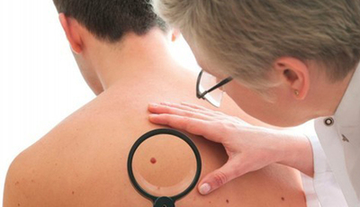 Dudas Frecuentes | Láser y Eléctrica