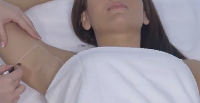 Primera Sesión | Láser o Eléctrica