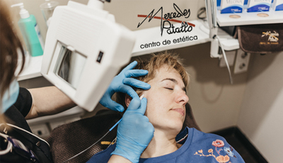 Depilación Eléctrica